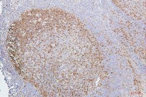 IHC analysis of CDK1 using anti-CDK1 antibody (ABIN7602240). (CDK1 anticorps  (AA 66-297))