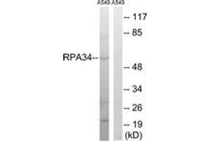 Western blot analysis of extracts from A549 cells, using CD3EAP Antibody. (CD3EAP anticorps  (AA 441-490))
