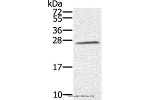 Western blot analysis of K562 cell, using SSX1 Polyclonal Antibody at dilution of 1:350 (SSX1 anticorps)