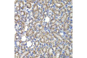 Immunohistochemistry of paraffin-embedded rat kidney using COPS2 antibody at dilution of 1:100 (x400 lens). (COPS2 anticorps)