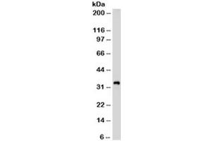 Western blot testing of Jurkat cell lysate with CD99 antibody (clone HO36-1. (CD99 anticorps)