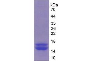 SDS-PAGE of Protein Standard from the Kit (Highly purified E. (FURIN Kit ELISA)