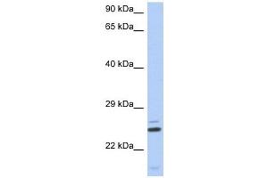 TTC9C antibody used at 1 ug/ml to detect target protein. (TTC9C anticorps  (N-Term))