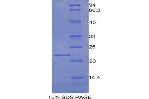 SDS-PAGE analysis of Rat PROCR Protein. (PROCR Protéine)