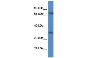 WB Suggested Anti-Slc6a9 AntibodyTitration: 1. (GLYT1 anticorps  (C-Term))