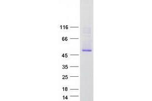 Validation with Western Blot