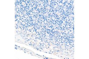 Immunohistochemistry of paraffin-embedded Human tonsil (negative control sample) using CDX2 antibody  at dilution of 1:300 (40x lens).