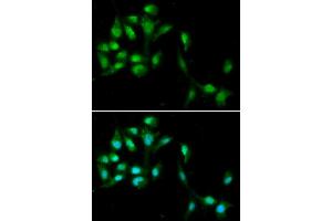 Immunofluorescence analysis of A549 cells using HEXIM1 antibody (ABIN5973397). (HEXIM1 anticorps)