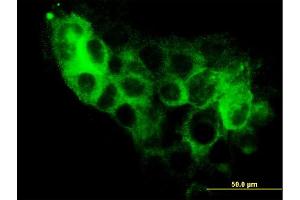 Immunofluorescence of monoclonal antibody to STEAP1 on A-431 cell. (STEAP1 anticorps  (AA 1-339))