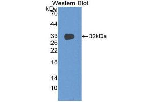 Western Blotting (WB) image for anti-DNA Fragmentation Factor, 45kDa, alpha Polypeptide (DFFA) (AA 51-305) antibody (ABIN3202366) (DFFA anticorps  (AA 51-305))