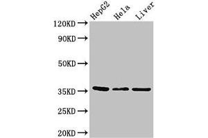 Western Blot Positive WB detected in: HepG2 whole cell lysate, Hela whole cell lysate, Mouse liver tissue All lanes: SPRY1 antibody at 2. (SPRY1 anticorps  (AA 1-178))