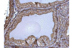IHC-P Image beta Actin antibody detects beta Actin protein at cytosol on mouse prostate by immunohistochemical analysis.