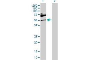 Western Blot analysis of SH2B1 expression in transfected 293T cell line by SH2B1 MaxPab polyclonal antibody. (SH2B1 anticorps  (AA 1-426))