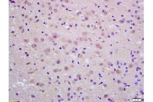 Formalin-fixed and paraffin embedded rat brain labeled with Anti-Neprilysin 2 Polyclonal Antibody, Unconjugated (ABIN1386041) at 1:200 followed by conjugation to the secondary antibody and DAB staining (MMEL1 anticorps  (AA 451-550))