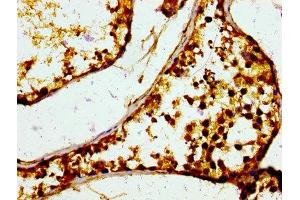 IHC image of ABIN7158882 diluted at 1:400 and staining in paraffin-embeddedhuman testis tissue performed on a Leica BondTM system.