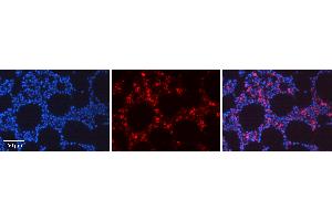 Rabbit Anti-REL Antibody Catalog Number: ARP36966_P050 Formalin Fixed Paraffin Embedded Tissue: Human Bone Marrow Tissue Observed Staining: Nucleus, Cytoplasm Primary Antibody Concentration: 1:100 Other Working Concentrations: 1:600 Secondary Antibody: Donkey anti-Rabbit-Cy3 Secondary Antibody Concentration: 1:200 Magnification: 20X Exposure Time: 0. (c-Rel anticorps  (Middle Region))