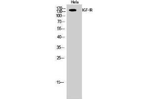 Western Blotting (WB) image for anti-Insulin-Like Growth Factor 1 Receptor (IGF1R) (Ser1026) antibody (ABIN3175593) (IGF1R anticorps  (Ser1026))