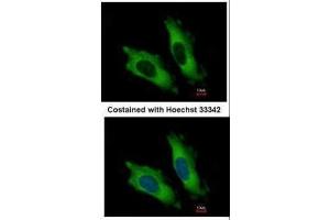 ICC/IF Image Immunofluorescence analysis of methanol-fixed HeLa, using EIF4A2, antibody at 1:500 dilution. (EIF4A2 anticorps)