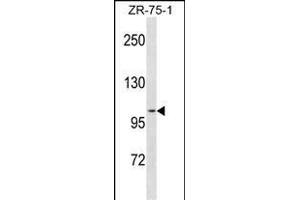 PGR Antibody (C-term) (ABIN1881650 and ABIN2838815) western blot analysis in ZR-75-1 cell line lysates (35 μg/lane). (Progesterone Receptor anticorps  (C-Term))