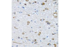 Immunohistochemistry of paraffin-embedded mouse spinal cord using RARS antibody (ABIN5973728) at dilution of 1/100 (40x lens). (RARS anticorps)
