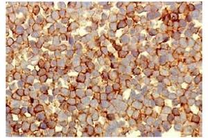 Immunohistochemistry (IHC) image for anti-Tumor Necrosis Factor Receptor Superfamily, Member 8 (TNFRSF8) antibody (ABIN492585)