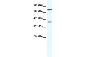 Western Blotting (WB) image for anti-Zinc Finger Protein 660 (ZNF660) antibody (ABIN2461324) (ZNF660 anticorps)