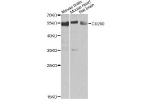 Western blot analysis of extracts of various cell lines, using CD200 antibody (ABIN2561685) at 1:1000 dilution. (CD200 anticorps)
