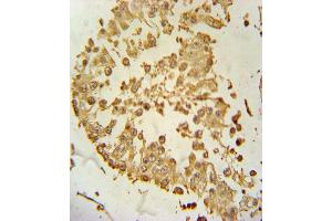 ZDHHC21 Antibody immunohistochemistry analysis in formalin fixed and paraffin embedded human testis tissue followed by peroxidase conjugation of the secondary antibody and DAB staining. (ZDHHC21 anticorps  (N-Term))