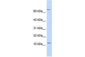 TRA16 antibody used at 1 ug/ml to detect target protein. (NR2C2AP anticorps  (N-Term))