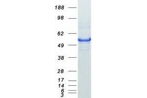 Validation with Western Blot