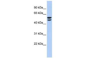 ATP6V1B2 antibody used at 1 ug/ml to detect target protein. (ATP6V1B2 anticorps  (N-Term))