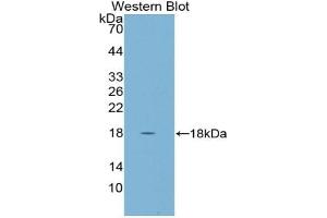 Western blot analysis of the recombinant protein. (CST5 anticorps  (AA 21-142))