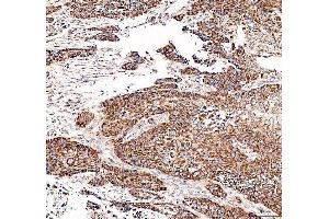 IHC analysis of DYNLT1 using anti-DYNLT1 antibody (ABIN5693148).