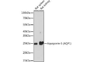 Western blot analysis of extracts of various cell lines, using Aquaporin-1 (Aquaporin-1 ) Rabbit mAb (ABIN1682901, ABIN3018679, ABIN3018680 and ABIN7101646) at 1:1000 dilution. (Aquaporin 1 anticorps)