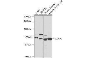 Western blot analysis of extracts of various cell lines, using SLC6 antibody (ABIN6130907, ABIN6148042, ABIN6148043 and ABIN6218497) at 1:1015 dilution.