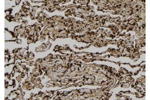 ABIN6261376 and ABIN6277015 at 1/100 staining Human lung tissue by IHC-P. (Dystonin anticorps  (C-Term))