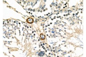 ABIN6260728 and ABIN6277053 at 1/100 staining Rat testis tissue by IHC-P.