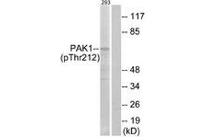 Western blot analysis of extracts from 293 cells treated with etoposide 25uM 1h, using PAK1 (Phospho-Thr212) Antibody. (PAK1 anticorps  (pThr212))