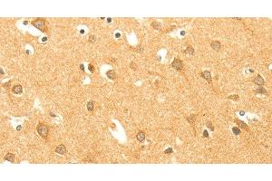 Immunohistochemistry of paraffin-embedded Human brain using AARS2 Polyclonal Antibody at dilution of 1:40
