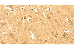 Immunohistochemistry of paraffin-embedded Human brain using AARS2 Polyclonal Antibody at dilution of 1:40