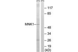 Western blot analysis of extracts from NIH-3T3 cells, using MNK1 (Ab-255) Antibody. (MKNK1 anticorps  (AA 221-270))