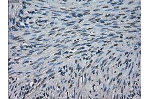 Image no. 1 for anti-Crystallin, alpha B (CRYAB) antibody (ABIN1497641) (CRYAB anticorps)