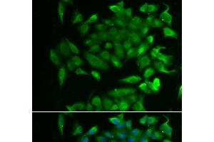 Immunofluorescence analysis of MCF-7 cells using RBP2 Polyclonal Antibody (RBP2 anticorps)