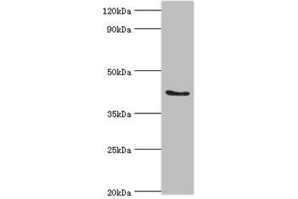 ADAP1 anticorps  (AA 1-374)