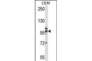 TLR2 Antibody (Center) (ABIN657617 and ABIN2846613) western blot analysis in CEM cell line lysates (35 μg/lane). (TLR2 anticorps  (AA 281-310))