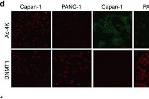 Acetylation of KGDNMT1impairs DNMT1-USP7 interaction and promotes the degradation of DNMT1.