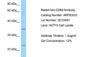 Western Blotting (WB) image for anti-CD69 (CD69) (Middle Region) antibody (ABIN2789344) (CD69 anticorps  (Middle Region))
