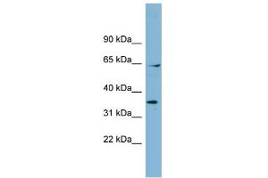 WB Suggested Anti-RANGAP1 Antibody Titration: 0. (RANGAP1 anticorps  (N-Term))