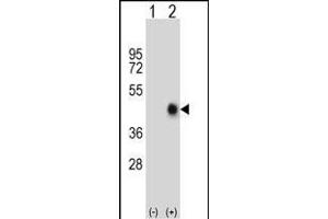 Western blot analysis of FAS (arrow) using rabbit polyclonal FAS Antibody (Center) (ABIN652469 and ABIN2842320). (FAS anticorps  (AA 185-211))
