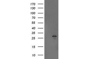 Western Blotting (WB) image for anti-Adenylate Kinase 4 (AK4) antibody (ABIN1496524) (AK4 anticorps)